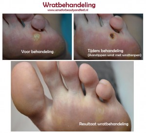 Wratbehandeling Nijkerk