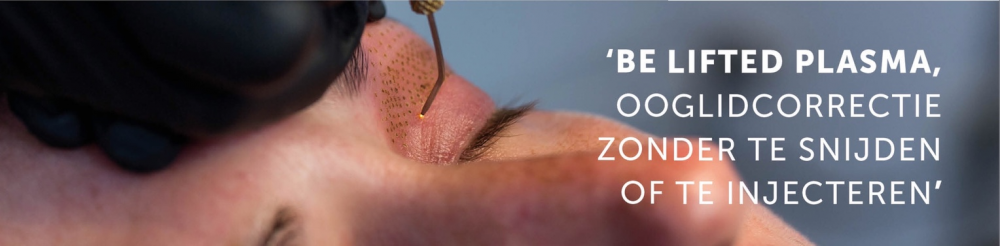 Liften zonder snijden